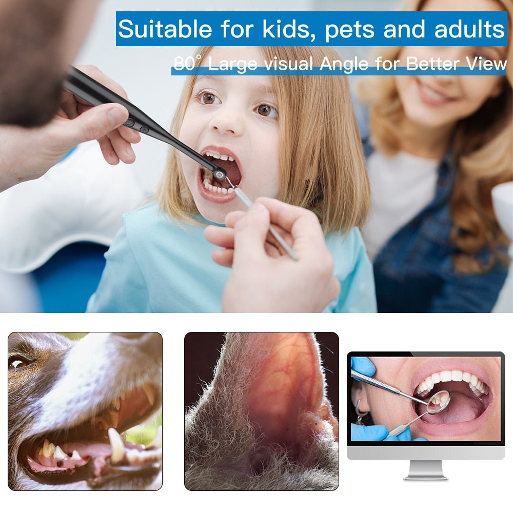 720P HD Intraoral Camera