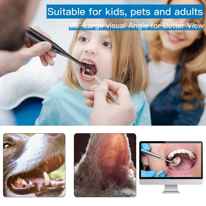 720P HD Intraoral Camera