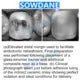 Dental Tofflemire Matrix for Deep Margin Elevation Large Curvature Matrices Retainer Sectional Contoured Matrice