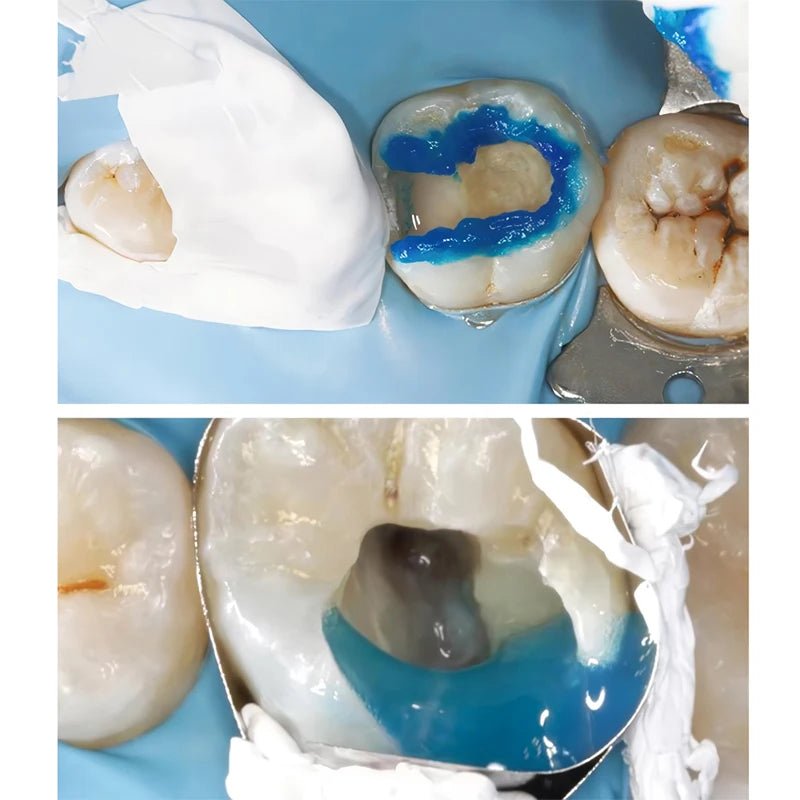 5m/roll Teflon Matrix Band