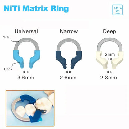 NITI Metal Sectional Matrix