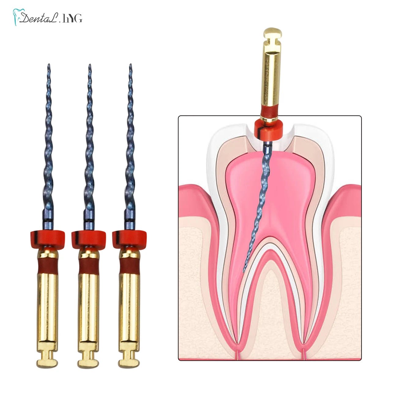 Super Gold Endo Rotary Files