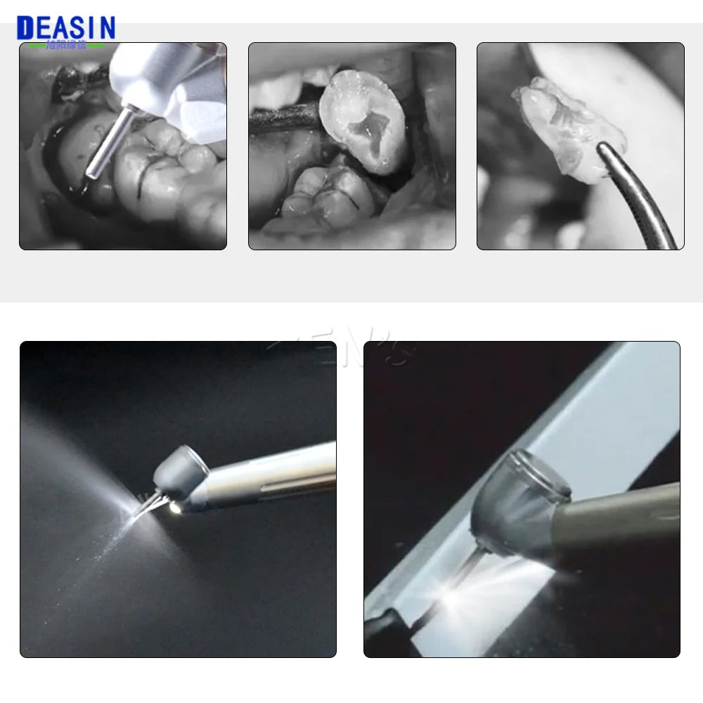 45 Degree LED Handpiece