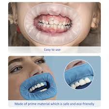 Cheek/Lip Retractor Rubber Dam