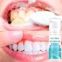 Professional Strength Teeth Whitening Gel for a Radiant Smile - Effective Tooth Whitening Products for Oral Hygiene